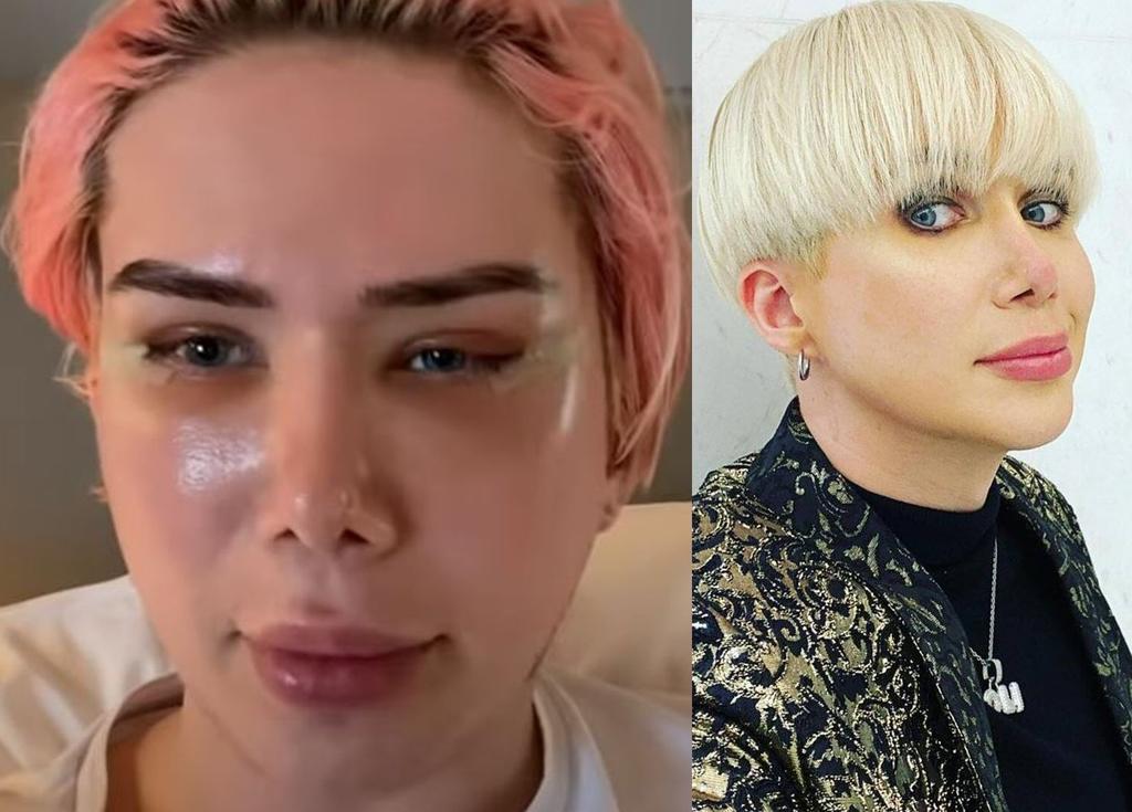 Oli London El Influencer No Binario Y Transracial Que Se Ha